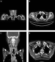 Iranian Journal of Radiology