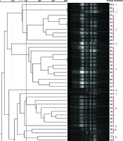 Jundishapur J Microbiol