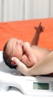 Associated Factors with Neonatal Weight Loss After Birth