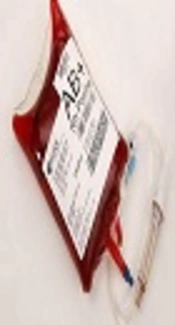 The Evaluation of Optimum Radiation Dose to Prevent Transfusion-Associated Graft-Versus-Host Disease Among the Iranian Population