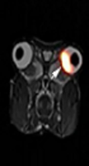 Ocular Biodistribution of <sup>89</sup>Zr-Bevacizumab in New Zealand Rabbits Determined Using PET/MRI: A Feasibility Study