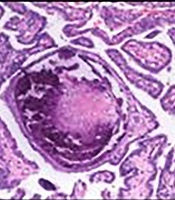 Iranian Journal of Radiology 