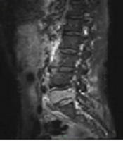 Iranian Journal of Radiology
