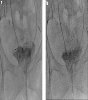 Iranian Journal of Radiology