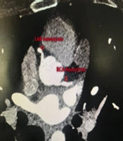 Multidisciplinary Cardiovascular Annals
