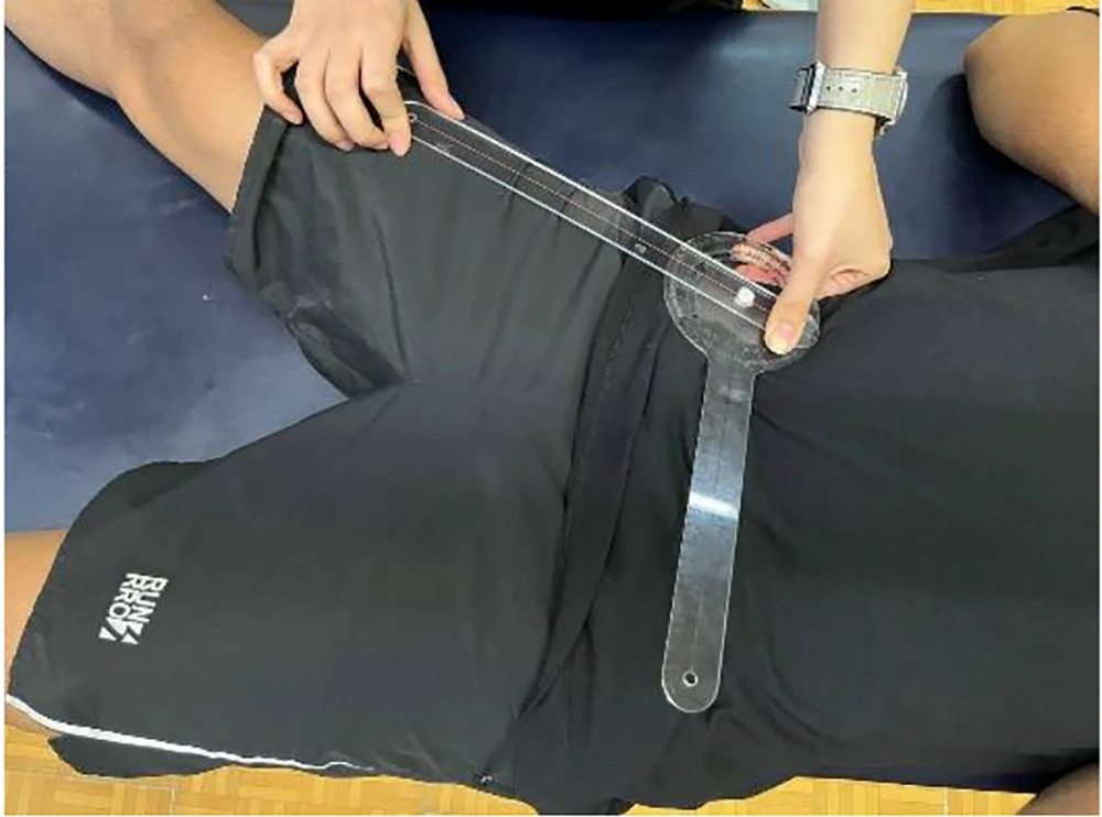 Goniometric measurement of hip abduction in supine position, aligned with anatomical landmarks Goniometric measurement of hip abduction in supine position, aligned with anatomical landmarks