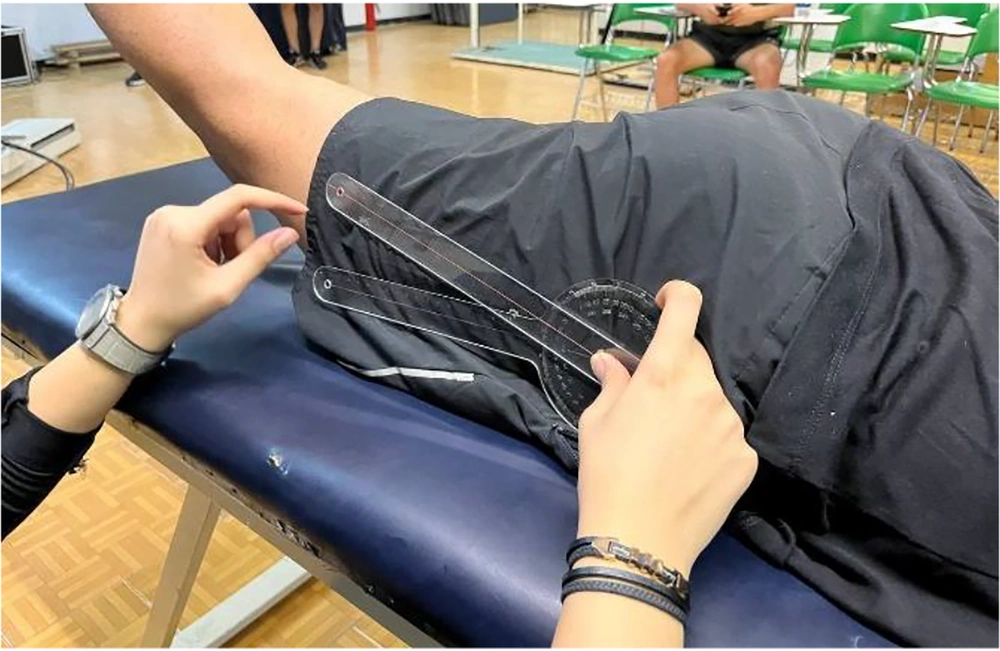 Prone hip extension measurement: Goniometer placed at greater trochanter, measuring angle between trunk and femur. Prone hip extension measurement: Goniometer placed at greater trochanter, measuring angle between trunk and femur.