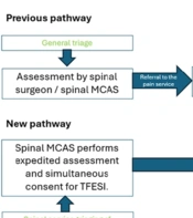 Enhanced Delivery of Transforaminal Epidural Steroid Injection (TFESI) for Radiculopathy Associated with Acute Lumbar Disc Prolapse Through Physiotherapist-led Assessment, Consent, and Direct Listing