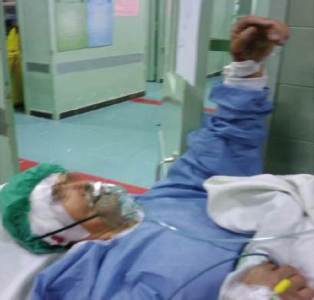 Recovery Room Just After the Operation: The Patient Was Awake and Had Stable Vital Signs. Recovery Room Just After the Operation: The Patient Was Awake and Had Stable Vital Signs.