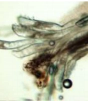 Prevalence of Demodex in Association with Ocular Signs and Symptoms: Evidence from a Large Population of Male Soldiers Living in Garrison