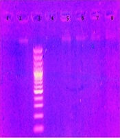 The Effect of EDTA Buffer and Temperature on DNA Extraction from Teeth for Molecular Forensic Assessment