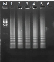 A Rapid Method for Detection of Crimean Congo Hemorrhagic Fever Virus with Loop-Mediated Isothermal Ampliﬁcation Assay