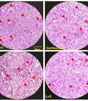 Effects of Topical Sambucus ebulus Combined with Systemic Losartan Potassium on Burn Wound Healing and Vascular Remodeling in Rats