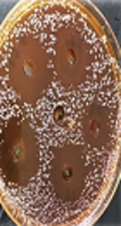 Anti-Microbial Effect of <i>Aloe vera</i> Extract on Clotrimazole-Resistant <i>Malassezia Furfur</i> Strains Isolated From Patients with Seborrheic Dermatitis in the City of Sari