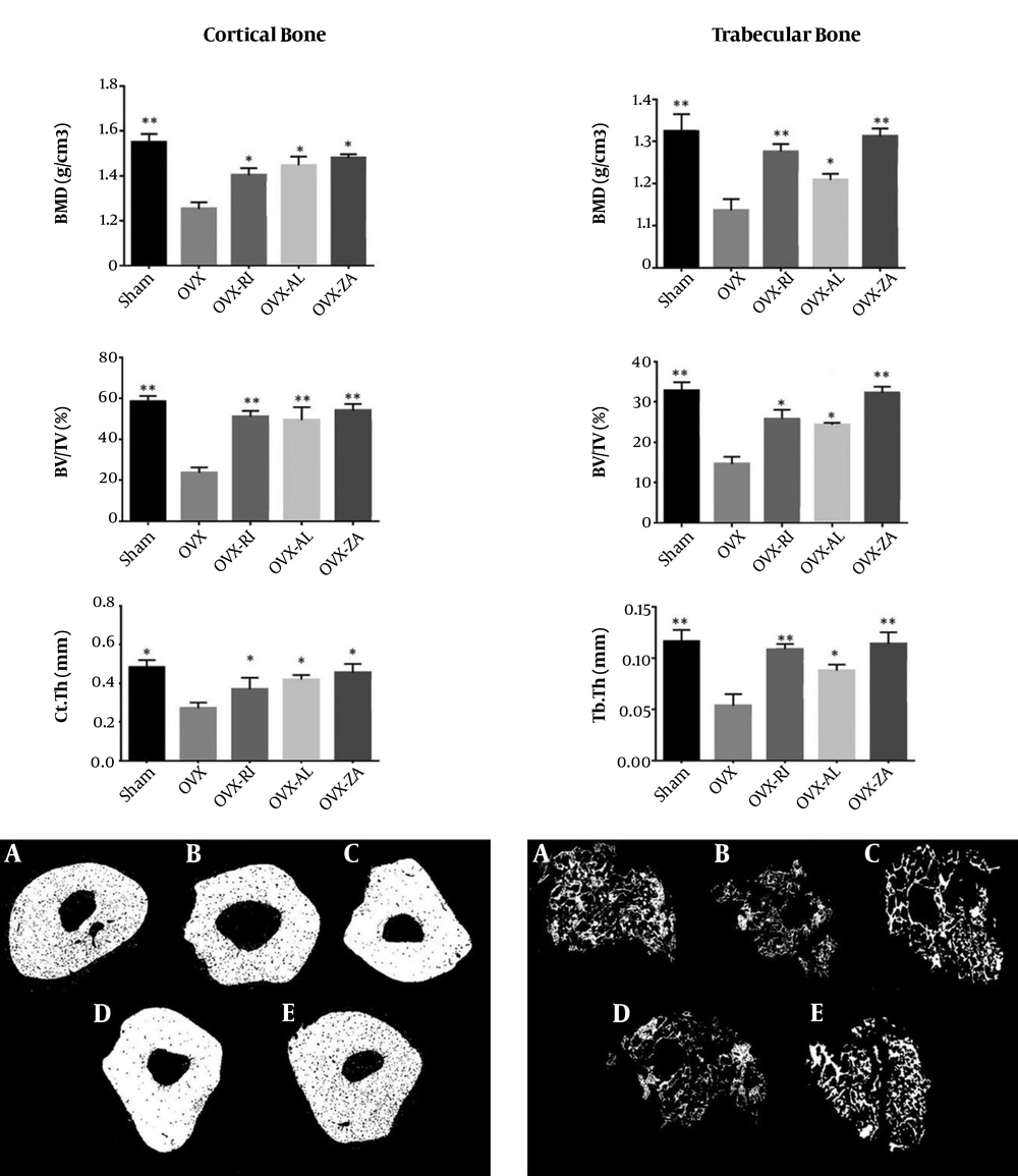 Micro CT analysis of different experimental groups 8 weeks after treatment, A, sham; B, OVX (PBS treated ovariectomized rat); C, OVX-RI (risedronate treated ovariectomized rat); D, OVX-AL (alendronate treated ovariectomized rat); E, OVX-ZA (zoledronic acid treated ovariectomized rat), BMD: bone mineral density, BV/TV: bone volume/total volume, Ct/Th: cortical bone thickness, Tb.Th: trabecular bone thickness, *,**: indicates treatment group versus un-treatment OVX group, **P < 0.01, *P < 0.05. Micro CT analysis of different experimental groups 8 weeks after treatment, A, sham; B, OVX (PBS treated ovariectomized rat); C, OVX-RI (risedronate treated ovariectomized rat); D, OVX-AL (alendronate treated ovariectomized rat); E, OVX-ZA (zoledronic acid treated ovariectomized rat), BMD: bone mineral density, BV/TV: bone volume/total volume, Ct/Th: cortical bone thickness, Tb.Th: trabecular bone thickness, *,**: indicates treatment group versus un-treatment OVX group, **P < 0.01, *P < 0.05.