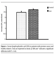 Serum Lysophosphatidic Acid as a Potential Biomarker of Prostate Cancer