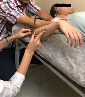 Cover image of the article: Effect of Selected Corrective Exercises on Glenohumeral Internal Rotation in Female Adolescent Swimmers with Scapular Dyskinesis