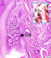 Hazardous Hyperglisemic Effect of Facial Ischemia Following Subarachnoid Hemorrhage: An Experimental Study