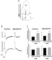 Effect of Nortriptyline on Spreading Depolarization