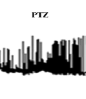 The Effect of Valproate Sodium on the Electrical Activity of Helix aspersa F1 Neurons in a Pentylenetetrazole-Induced Epileptic Model Using an Intracellular Recording System