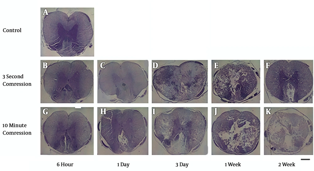 Cavity formation gradually increases over time following spinal cord compression at the 5 mm rostral to the injury site. Light microscopic evaluation of cresyl violet staining of the spinal cord sections at 3- and 14-days post-SCI shows greater cyst cavity in the 10-minute compression group compared to the 3-second compression group. (scale bar: 100µm). A: control group, B: 3second- 6hour, C: 3second- 1day, D: 3second- 3day, E; 3second-1week, F: 3second- 2week, G: 10minute-6hour, H: 10minute-1day, I: 10minute-3day, J: 10minute-1week, K: 10minute- 2week. Cavity formation gradually increases over time following spinal cord compression at the 5 mm rostral to the injury site. Light microscopic evaluation of cresyl violet staining of the spinal cord sections at 3- and 14-days post-SCI shows greater cyst cavity in the 10-minute compression group compared to the 3-second compression group. (scale bar: 100µm). A: control group, B: 3second- 6hour, C: 3second- 1day, D: 3second- 3day, E; 3second-1week, F: 3second- 2week, G: 10minute-6hour, H: 10minute-1day, I: 10minute-3day, J: 10minute-1week, K: 10minute- 2week.