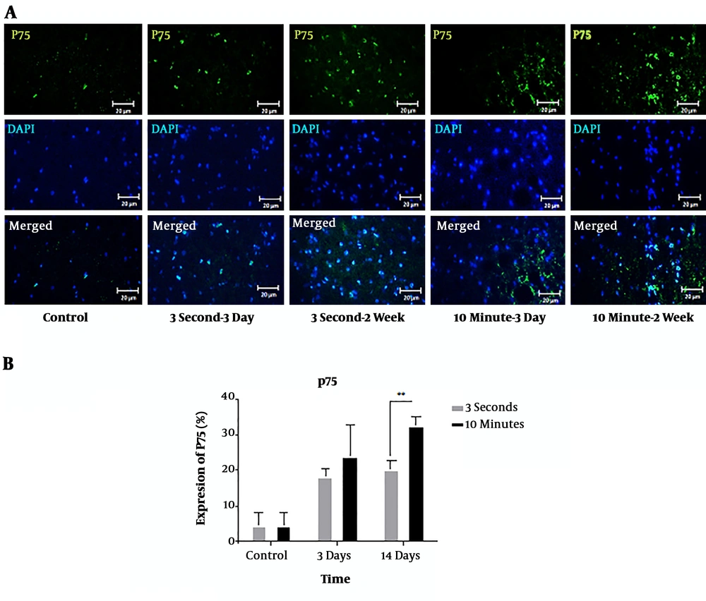 Immunohistochemical staining of p75NTR protein following 3-second and 10-minute compression at the 5 mm rostral to the injury site. A) Immunostaining for p75 revealed various amounts in the spinal cord sections of T9 in the different groups at 3- and 14-days post-SCI. p75-positive cells are stained green, while the nuclei are stained with DAPI (blue) (20× magnification) (scale bar: 20 µm). B) Comparison of p75NTR expression changes at the 5 mm rostral to the injury site. The staining intensity in the 10-minute compression group is higher than in the 3-second compression group after 14 days and the control group. Data are expressed as the mean ± SEM. Analysis of variance was used for statistical analysis (n = 3). ** P < 0.01. Immunohistochemical staining of p75NTR protein following 3-second and 10-minute compression at the 5 mm rostral to the injury site. A) Immunostaining for p75 revealed various amounts in the spinal cord sections of T9 in the different groups at 3- and 14-days post-SCI. p75-positive cells are stained green, while the nuclei are stained with DAPI (blue) (20× magnification) (scale bar: 20 µm). B) Comparison of p75NTR expression changes at the 5 mm rostral to the injury site. The staining intensity in the 10-minute compression group is higher than in the 3-second compression group after 14 days and the control group. Data are expressed as the mean ± SEM. Analysis of variance was used for statistical analysis (n = 3). ** P < 0.01.