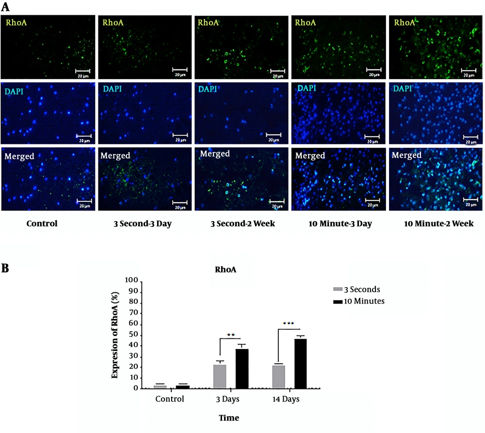 Immunohistochemical staining of RhoA protein following 3-second and 10-minute compression at the 5 mm rostral to the injury site. A) Immunostaining for RhoA revealed various amounts in the spinal cord sections of T9 in the different groups at 3- and 14-days post-SCI. RhoA-positive cells are stained green, while the nuclei are stained with DAPI (blue) (20× magnification) (scale bar: 20 µm). B) Comparison of RhoA expression changes at the 5 mm rostral to the injury site. The staining intensity in the 10-minute compression group is higher than in the 3-second compression group after both 3 days and 14 days and the control group. Data are expressed as the mean ± SEM. Analysis of variance was used for statistical analysis (n = 3). ** P < 0.01, *** P < 0.001. Immunohistochemical staining of RhoA protein following 3-second and 10-minute compression at the 5 mm rostral to the injury site. A) Immunostaining for RhoA revealed various amounts in the spinal cord sections of T9 in the different groups at 3- and 14-days post-SCI. RhoA-positive cells are stained green, while the nuclei are stained with DAPI (blue) (20× magnification) (scale bar: 20 µm). B) Comparison of RhoA expression changes at the 5 mm rostral to the injury site. The staining intensity in the 10-minute compression group is higher than in the 3-second compression group after both 3 days and 14 days and the control group. Data are expressed as the mean ± SEM. Analysis of variance was used for statistical analysis (n = 3). ** P < 0.01, *** P < 0.001.
