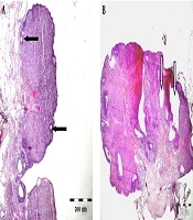 Polycystic Ovary Syndrome Can Lead to Neurocognitive Changes in Female Rats Treated with Letrozole