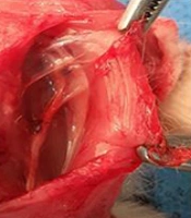 Cover image of the article: Effects of Adipose-Derived Mesenchymal Stem Cells and Human Amniotic Membrane on Sciatic Nerve Repair in Rats