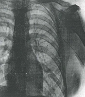 Werner Forssmann, the Man Behind the Self-experiment, and the Nobel Laureate: A Historical Note