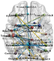 Improvement of Classification Performance in High-Dimension Low-Sample-Size Modeling by Sparse Functional Connectivity States in Subjects with Attention Deficit-Hyperactivity Disorder and Healthy Controls