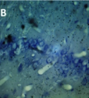 Cover image of the article: Effects of Chronic Pain Following Unilateral Ureteral Obstruction on Hippocampal CA1 Pyramidal Neurons in Male Wistar Rats
