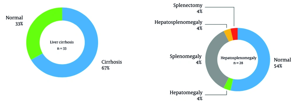 Liver cirrhosis and hepatosplenomegaly based on abdominopelvic sonography of patients Liver cirrhosis and hepatosplenomegaly based on abdominopelvic sonography of patients