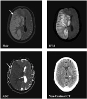 Arch Neurosc
