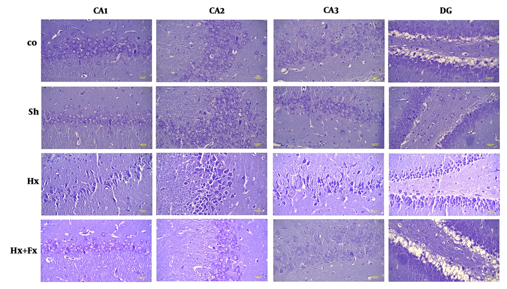 Effects of Fx supplementation on histological changes in the hippocampus of rats with hypoxia. Histological changes in the hippocampus of rats during hypoxia induction and the effect of flaxseed on the histopathology of different areas of the hippocampus (Cresyl Violet (Nissl) staining, X400). Hypoxia leads to disturbed neuronal density in different areas of the hippocampus and significant improvements were observed in the Hx + Fx group. Co = control, Sh = sham, Hx = hypoxia, Hx + Fx = hypoxia treatment with flaxseed. Effects of Fx supplementation on histological changes in the hippocampus of rats with hypoxia. Histological changes in the hippocampus of rats during hypoxia induction and the effect of flaxseed on the histopathology of different areas of the hippocampus (Cresyl Violet (Nissl) staining, X400). Hypoxia leads to disturbed neuronal density in different areas of the hippocampus and significant improvements were observed in the Hx + Fx group. Co = control, Sh = sham, Hx = hypoxia, Hx + Fx = hypoxia treatment with flaxseed.