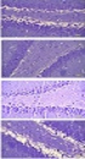 Anti-Oxidative and Neuroprotective Effects of Supplementary Flaxseed on Oxidative Damage in the Hippocampus Area of a Rat Model of Hypoxia