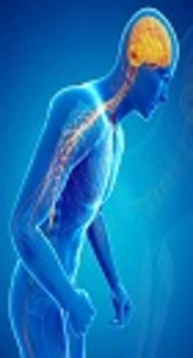 Cover image of the article: The Association Between Low Levels of Serum Vitamin D and the Duration and Severity of Parkinson’s Disease
