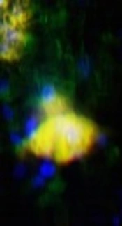 The Ability of 3D Alginate/Polyvinyl Alcohol Cross-Linked Hybrid Hydrogel to Differentiate Periodontal Ligament Stem Cells Into Osteoblasts