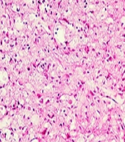 Cover image of the article: The Effect of Four Weeks of Low-Level Laser Radiation (660 nm) on Movement Recovery and Fibroblasts Invasion