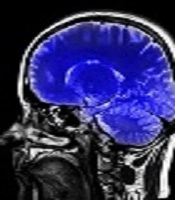 Brain Mapping and Neuroscience