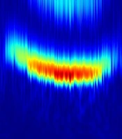 Cover image of the article: Cortico-Thalamic Circuit Model for Bottom-Up and Top-Down Mechanisms in General Anesthesia Involving the Reticular Activating System