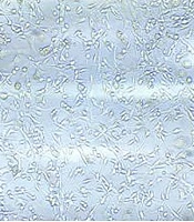 Cover image of the article: Primary Spinal Cord Neurons Better Attach to Non-Coated Surfaces Than to Poly(D-lysine)-Coated Surfaces
