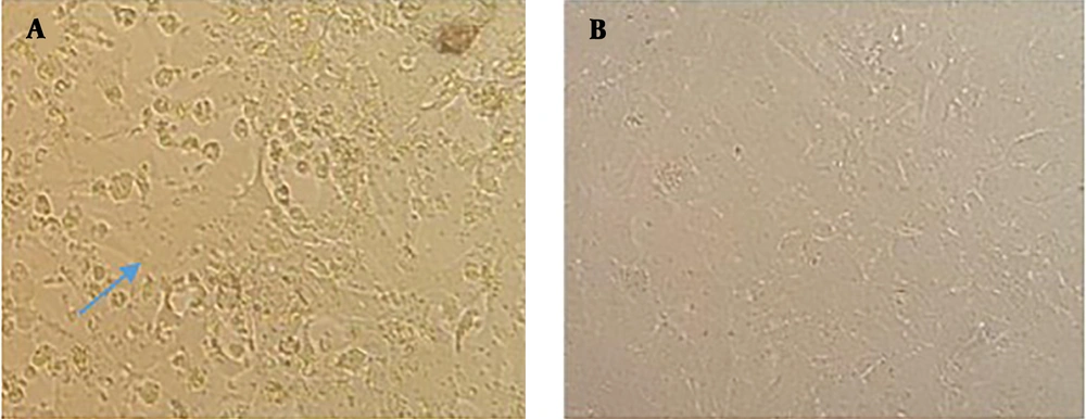 A, Measles virus rescue after co-transfection with pAIKc-rMV, pT7N1P5, and pEMC-La visualized with vast syncytia formation (shown by arrow) after five days; B, negative control of HEK-293 cells transfected with pAIKc-rMV and pT7N1P5 plasmids. A, Measles virus rescue after co-transfection with pAIKc-rMV, pT7N1P5, and pEMC-La visualized with vast syncytia formation (shown by arrow) after five days; B, negative control of HEK-293 cells transfected with pAIKc-rMV and pT7N1P5 plasmids.