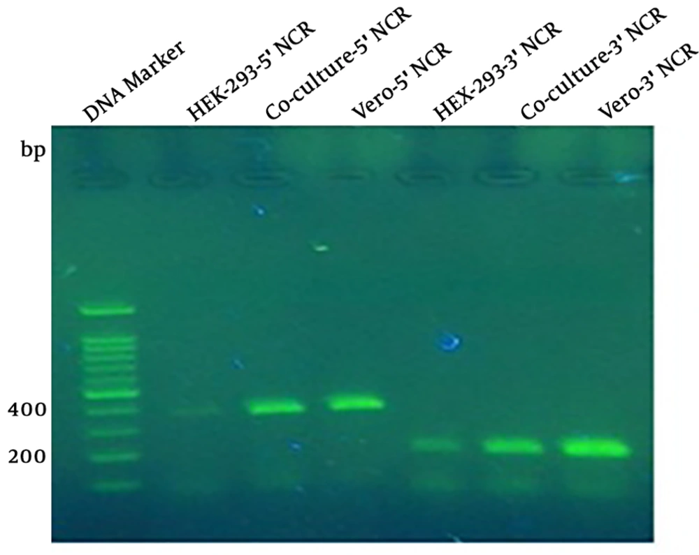 The RT-PCR to amplify 5’NCR and 3’NCR from rescued MV. The amplification results of 5’NCR and 3’NCR showed 392-bp and 184-bp bands. Lane 1 is related to the DNA marker; lanes 2, 3, and 4 are positive amplification results of 5’NCR sequence of transfected HEK-293 cells, rescued measles virus from transfected HEK-293 co-culture cells with Vero cells, and inoculated Vero cells with rescued measles virus, respectively; lanes 5, 6, and 7 are positive amplification results of 3’NCR sequence of rescued measles virus from HEK-293 cells, co-culture system, and inoculated measles virus, respectively. The RT-PCR to amplify 5’NCR and 3’NCR from rescued MV. The amplification results of 5’NCR and 3’NCR showed 392-bp and 184-bp bands. Lane 1 is related to the DNA marker; lanes 2, 3, and 4 are positive amplification results of 5’NCR sequence of transfected HEK-293 cells, rescued measles virus from transfected HEK-293 co-culture cells with Vero cells, and inoculated Vero cells with rescued measles virus, respectively; lanes 5, 6, and 7 are positive amplification results of 3’NCR sequence of rescued measles virus from HEK-293 cells, co-culture system, and inoculated measles virus, respectively.