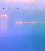 Cover image of the article: The Place of Group A Streptococci in Moroccan Children with Pharyngitis and Emm Type Distribution