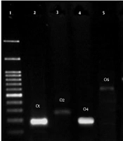 Phylogenetic Groups/B2 Subgroup Distributions, Serogrouping and Identification of Virulence Factors in Extended-Spectrum Cephalosporin-Resistant Escherichia coli Strains Isolated from the Stool of Healthy Children Under 10 Years Old