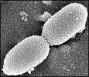 Truncated D Protein as a New Vaccine Candidate Against Nontypeable Haemophilus influenza