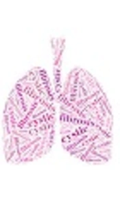 The Acute Effect of Inhaled NaCl 5%, Per CF TRUST Protocol, on Spirometry Indices in Patients Over Six Years with Cystic Fibrosis