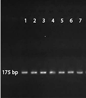 The First Fungal Identification from Mini-BAL of Critical COVID-19 Patients