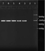 Cover image of the article: Relationship Between Prevalence of Pneumococcal Serotypes and Their Neuraminidases in Carriers, Predictive Facts?